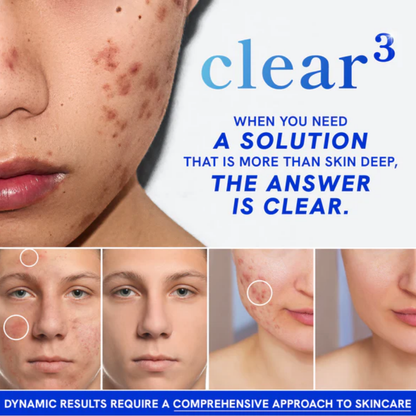 Clear3 Skin Support (60 Capsules)