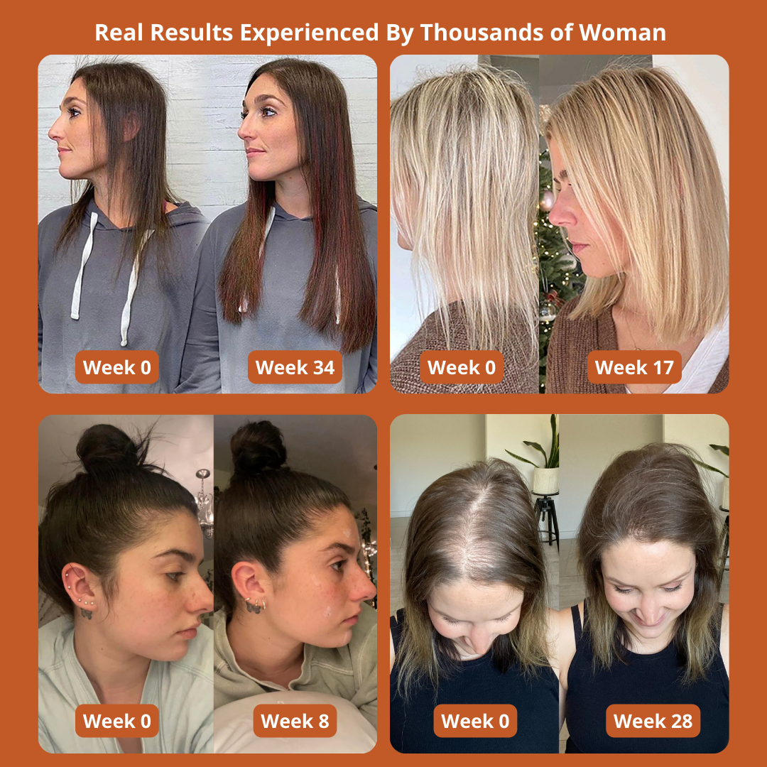 Pumpkin Seed Oil Softgels