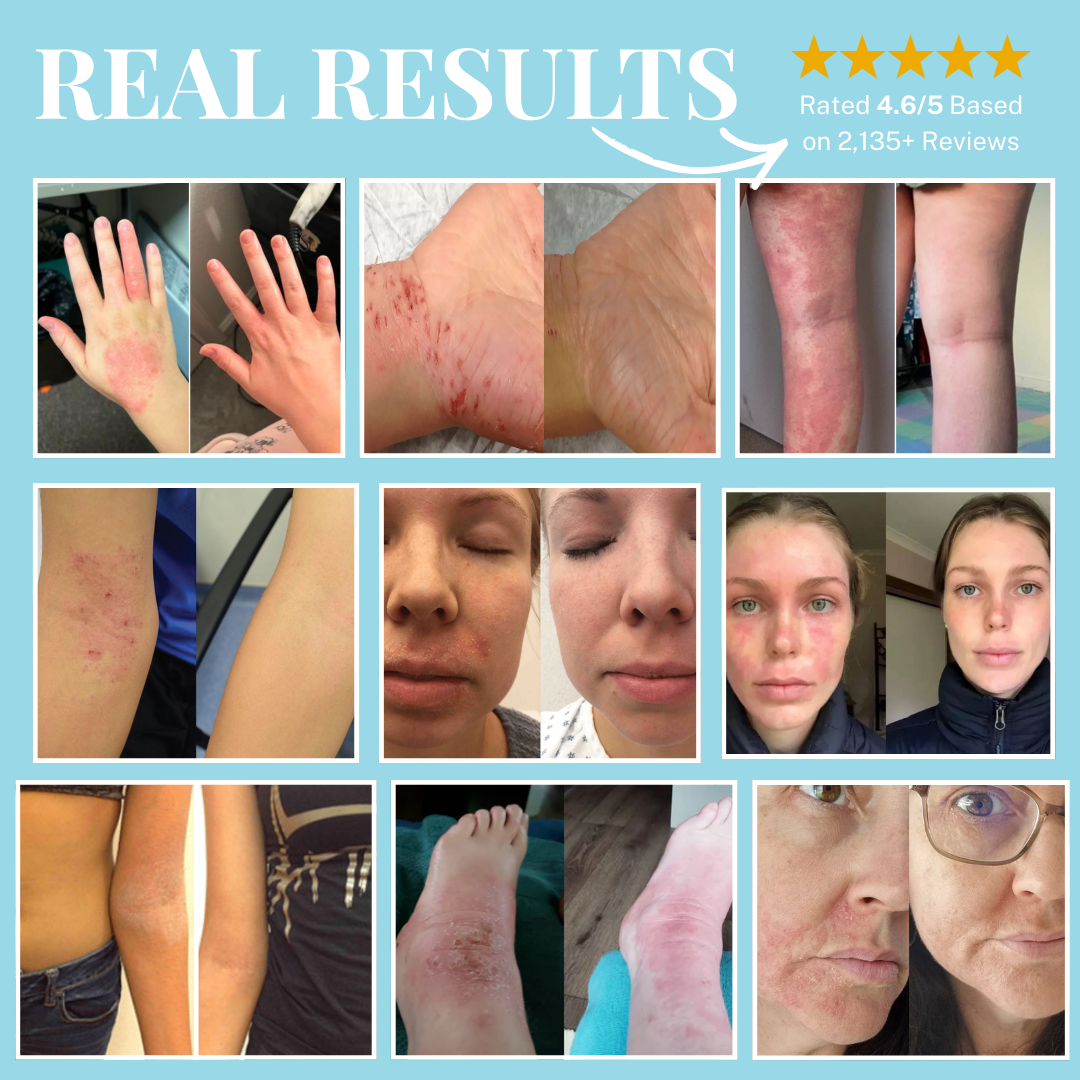 Barrier+ Soothing Cream (4 fl oz / 118ml)